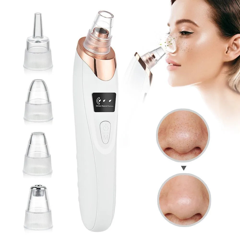 Electric Blackhead Remover - Pore Vacuum