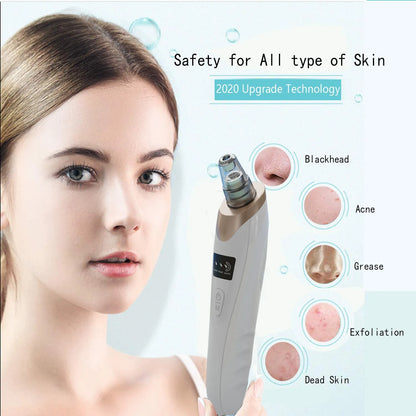 Electric Blackhead Remover - Pore Vacuum